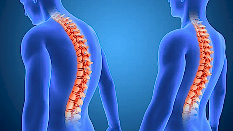 Degenerative Disc Disease: Causes, Symptoms and Treatment Methods