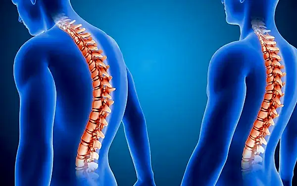 Dejeneratif Disk Hastalığı: Nedenleri, Belirtileri ve Tedavi Yöntemleri